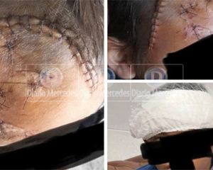 Violenta agresión a un menor en Mercedes el agresor identificado